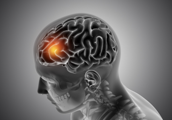 Ataxia: la enfermedad neurológica silenciosa que desafía a la ciencia